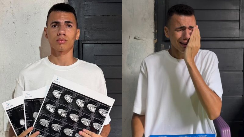 Influenciador Clemilson revela diagnóstico de tumor na mão e desabafa nas redes&nbsp;sociais